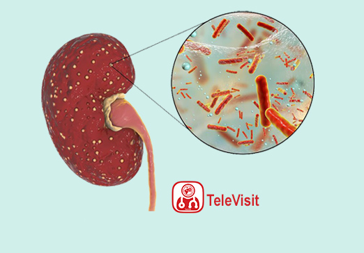 تشخیص و درمان عفونت کلیه