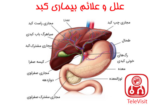 علل و علائم بیماری کبد