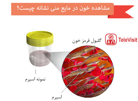 مشاهده خون در مایع منی نشانه چیست؟