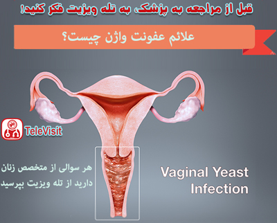 علائم عفونت واژن چیست؟