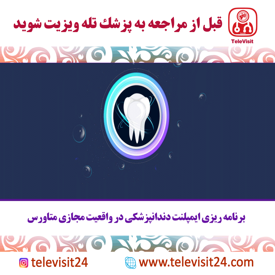 برنامه ریزی ایمپلنت دندانپزشکی در واقعیت مجازی متاورس 