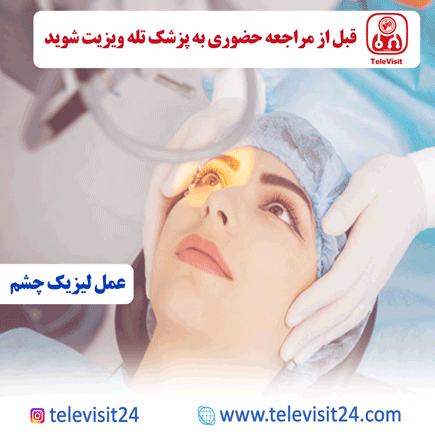 عمل لیزیک چشم