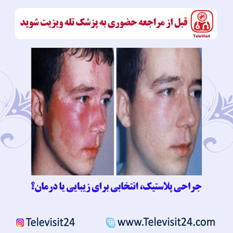جراحی پلاستیک، انتخابی برای زیبایی یا درمان؟