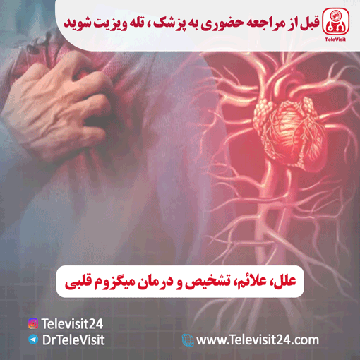 علل، علائم، تشخیص و درمان میگزوم قلبی